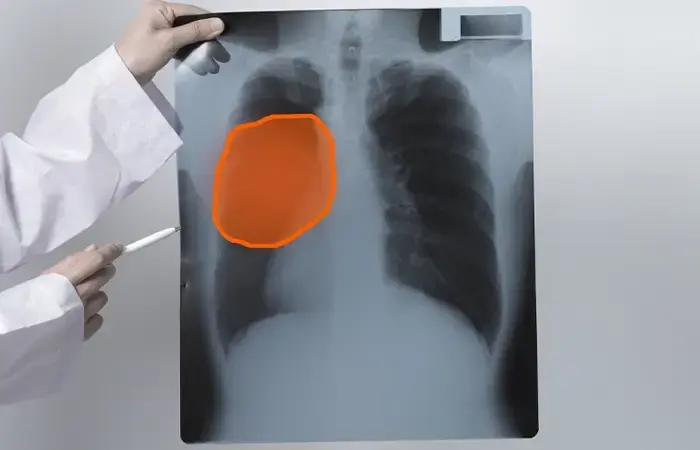Liver Diagnostics